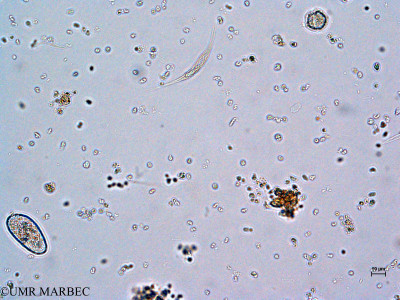 phyto/Thau_Lagoon/THAU_station1/GELAMED 2010/Calciosolenia brasiliensis (2)(copy)_thumb.jpg